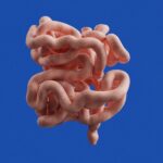 Could These 10 Common Gut Problems Be Linked to the Same Gut Imbalance?