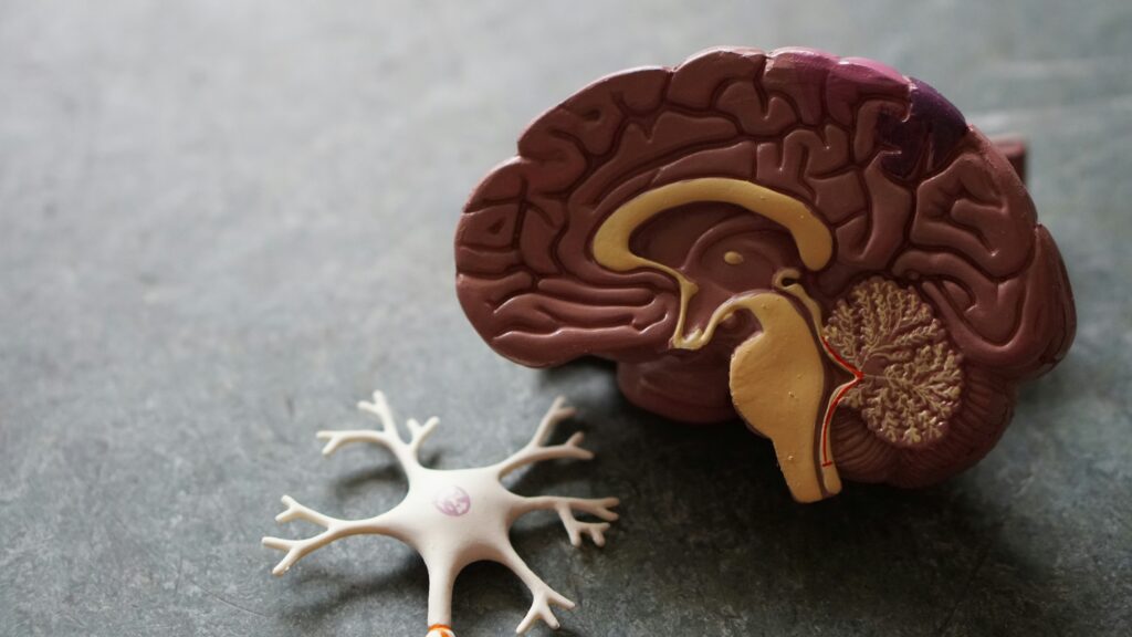 What Causes Alzheimer's?