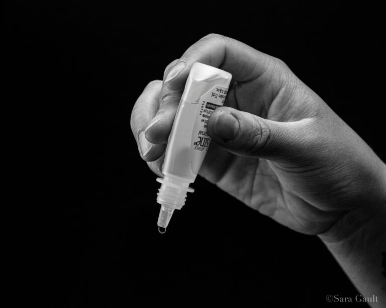 Quick Allergic Conjunctivitis Relief