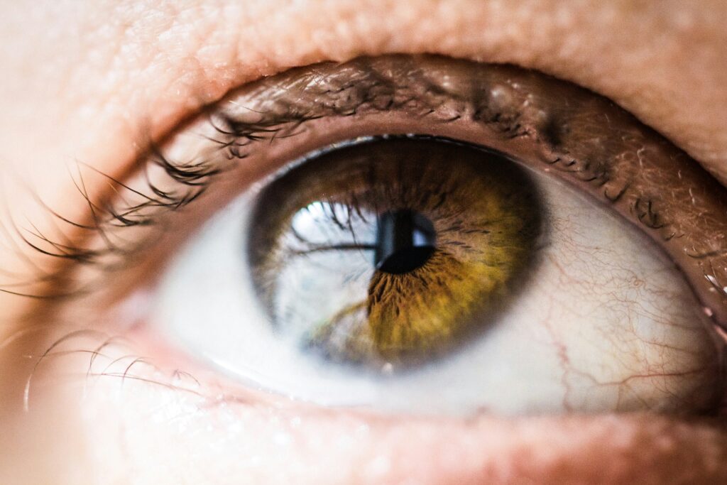How to Treat Allergic Conjunctivitis